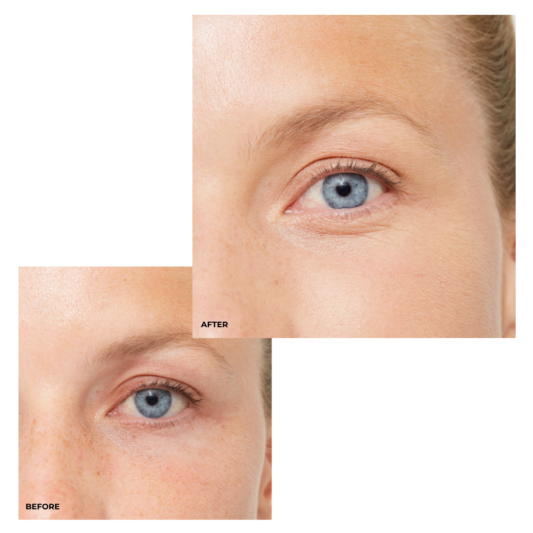 Concealer 001 Porcelain - Høj dækning til makeup!